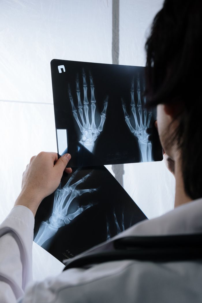 Mastering the First Impression: Your intriguing post title goes here A doctor examines hand x-ray images to assess possible fractures or injuries.