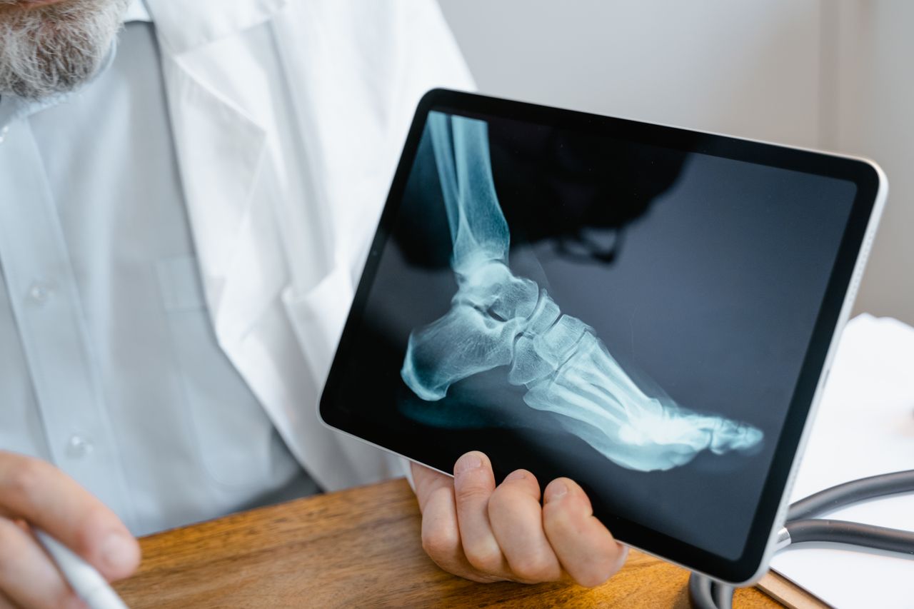 The Art of Drawing Readers In: Your attractive post title goes here A doctor examines an x-ray image of a foot displayed on a tablet.